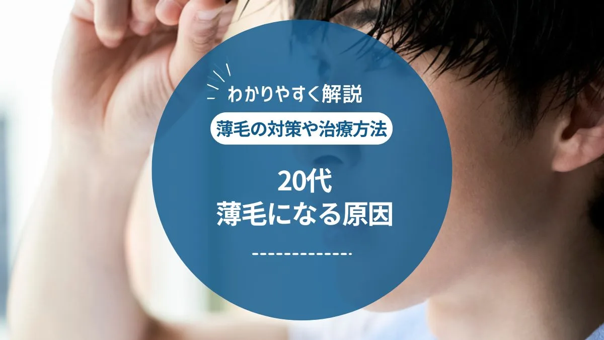 20代でAGAを発症する？薄毛になる原因や最適な治療法を解説